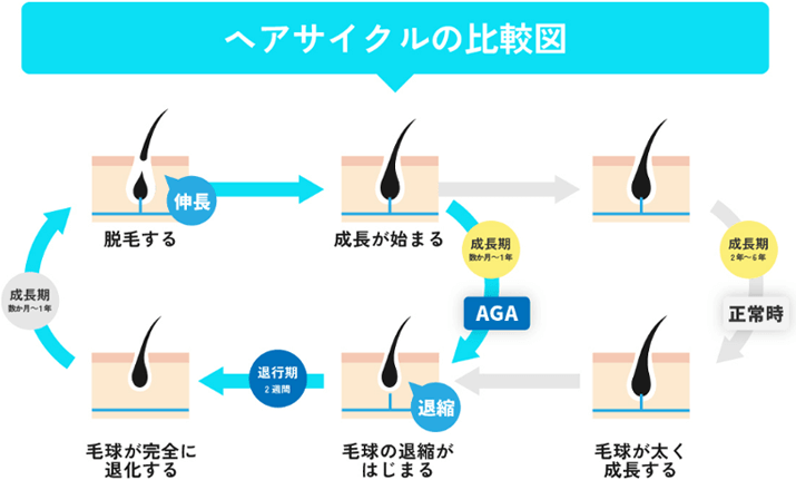 ヘアサイクルの比較図